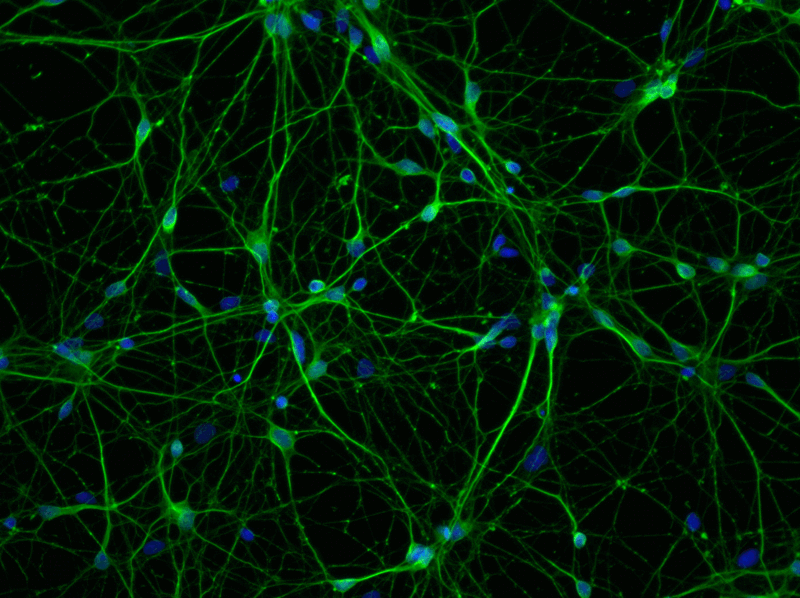 File:Neuronal.gif
